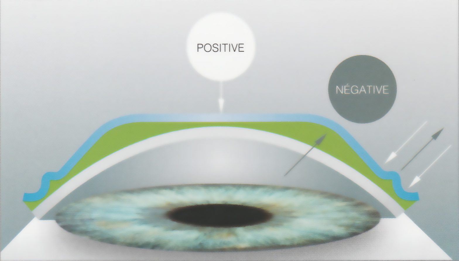 Lentilles-pour-orthokeratologie